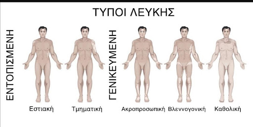 leuki2
