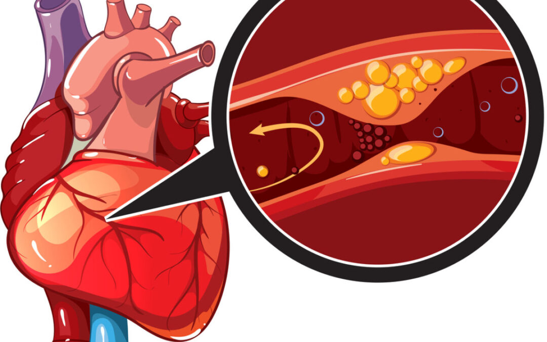 Understanding Heart Diseases: A Modern Healthcare Challenge