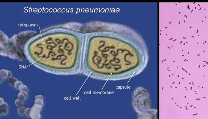 Laboratory-diagnosis-Treatment-and-Prevention-of-Streptococcus-pneumoniae